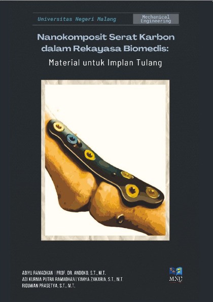 NANOKOMPOSIT SERAT KARBON DALAM REKAYASA BIOMEDIS: MATERIAL UNTUK IMPLAN TULANG